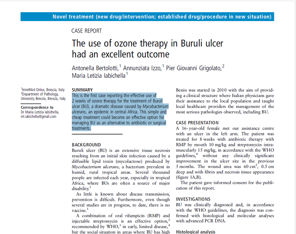 Ozone Therapy to Treat Buruli Ulcer - Case Study
